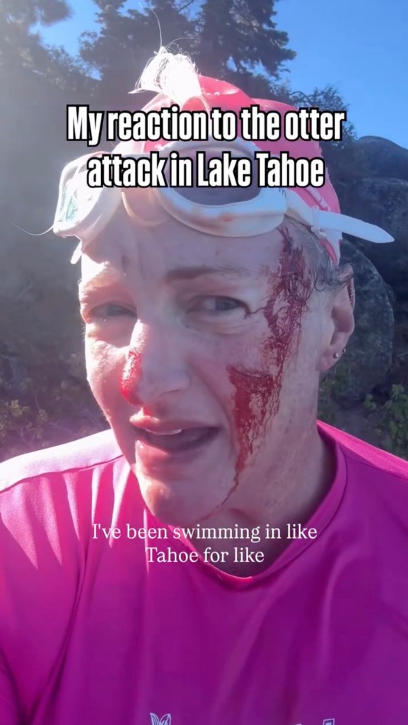 Swimmer mauled in vicious attack by ‘ruthless’ river otter: ‘It just kept coming’