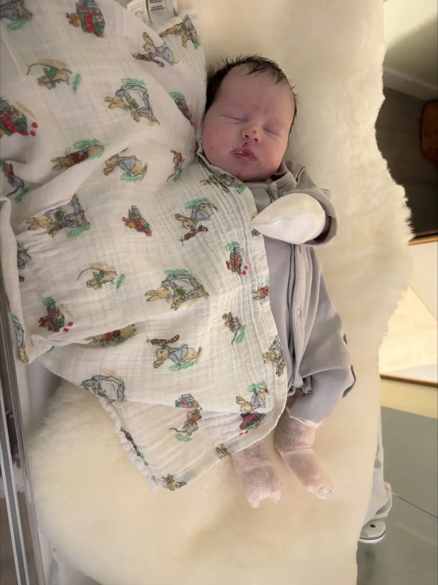 Mom who can't hold her baby because of rare ‘butterfly skin’ condition reveals painful first signs she noticed