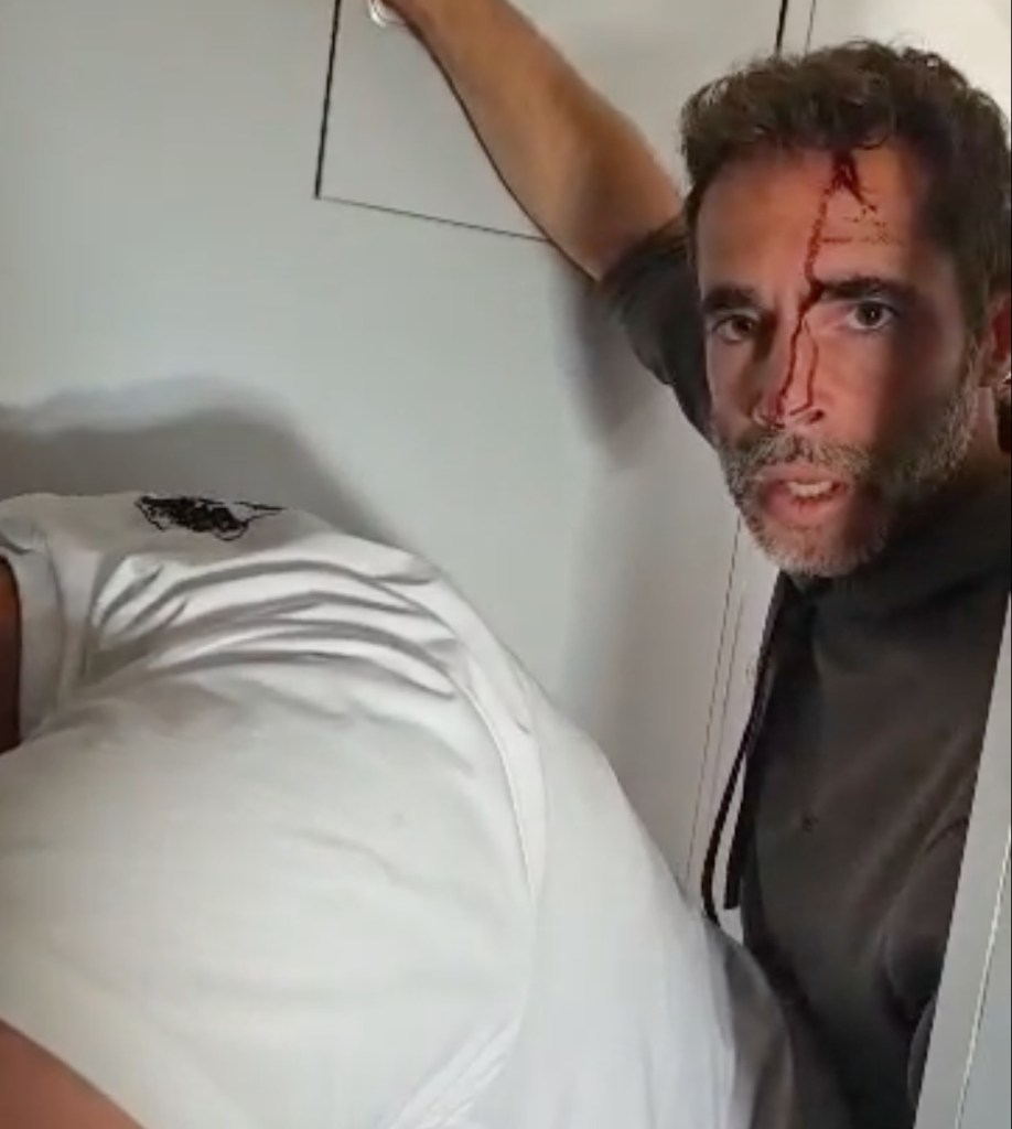 Graphic video shows blood-drenched pilot clinging to life after ‘attempted terror attack’