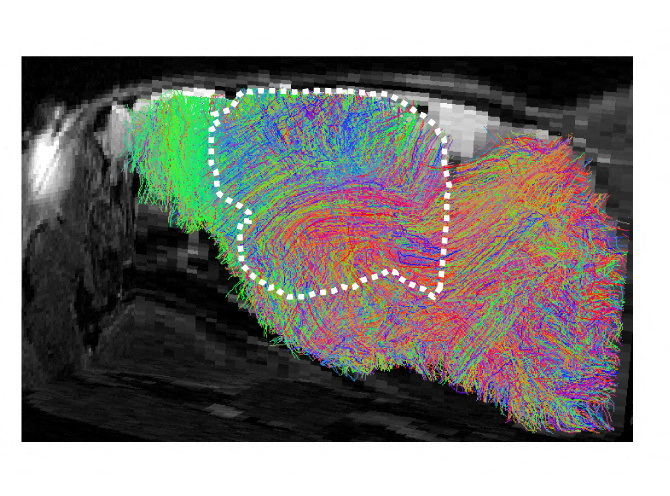 Stanford geniuses create lab rats with half-human brains