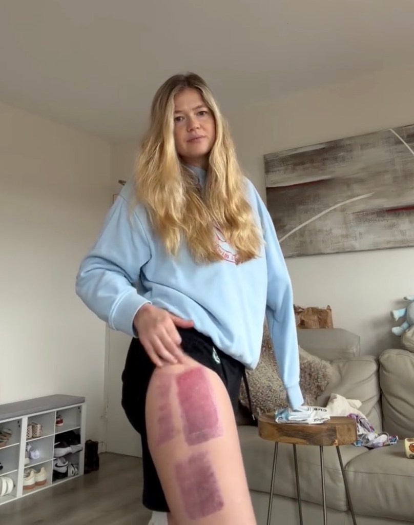 ‘Devastated’ shark attack survivor who lost an arm shares sad health news months after terrifying incident