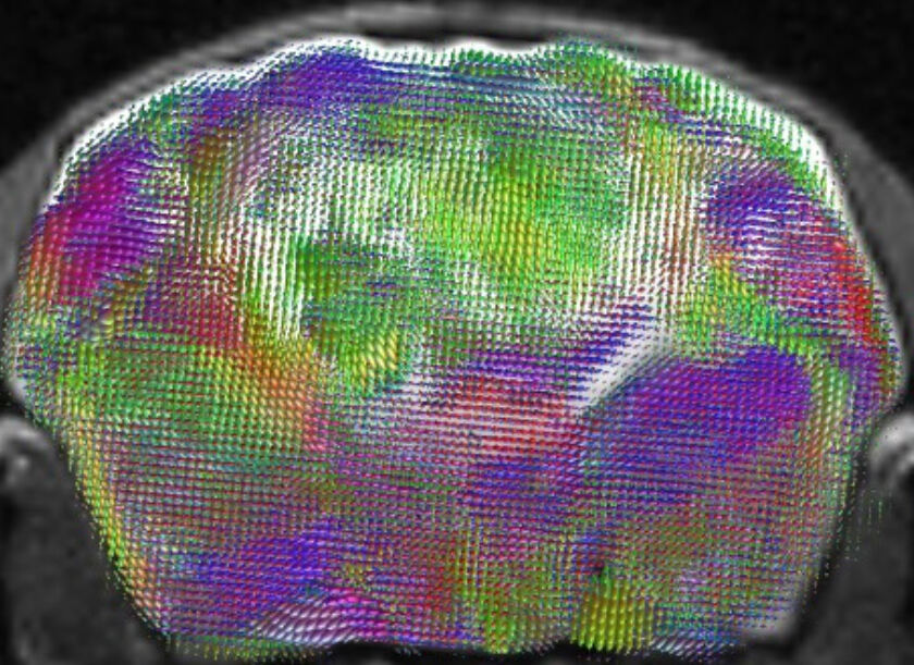Stanford geniuses create lab rats with half-human brains