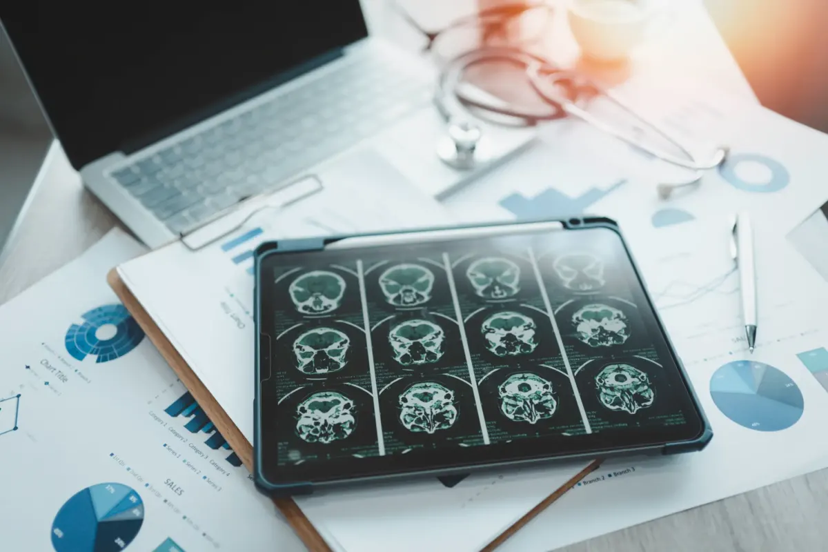 Oral condition that could increase dementia risk by more than 50%, according to study