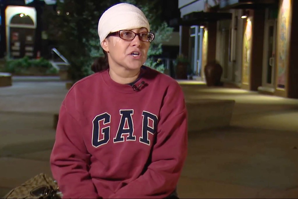 Woman accused of biting chunk out of victim’s forehead in ‘zombie bite’ attack