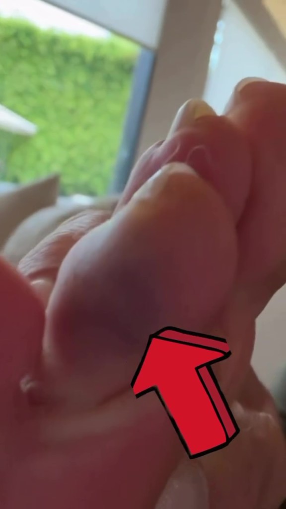 Giada De Laurentiis reveals gnarly injury ahead of ‘Dancing With the Stars’ premiere: ‘For sure gonna lose my toenail’