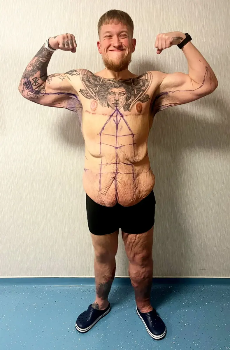 Man shares incredible transformation after losing 420 pounds and becoming a personal trainer