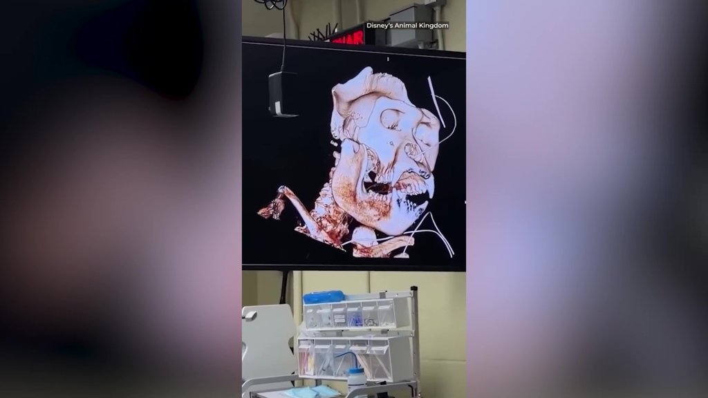 Gorilla poised to become next leader of the pack undergoes medical check-up — drawing crowd of onlookers