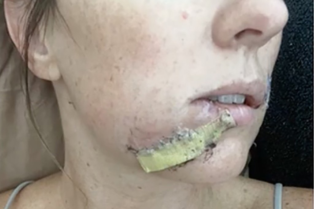 Arizona mom fights off crazed coyote with flip-flip after wild animal attacks 4-year-old daughter