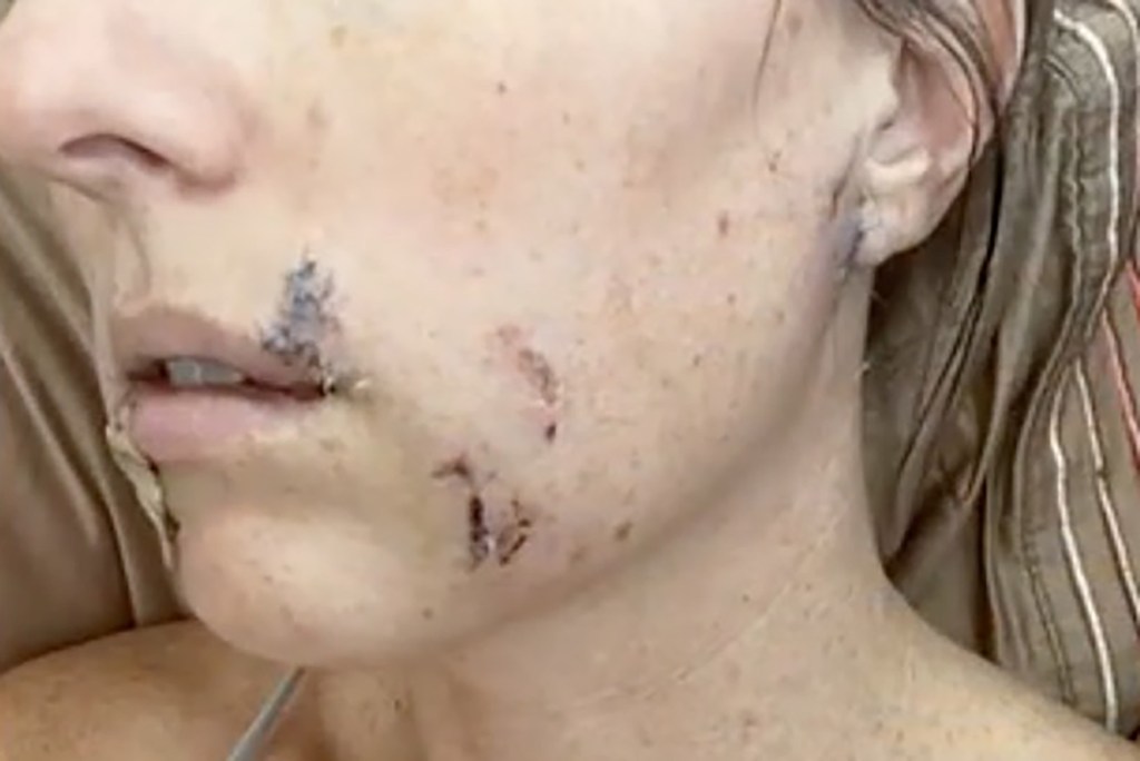 Arizona mom fights off crazed coyote with flip-flip after wild animal attacks 4-year-old daughter