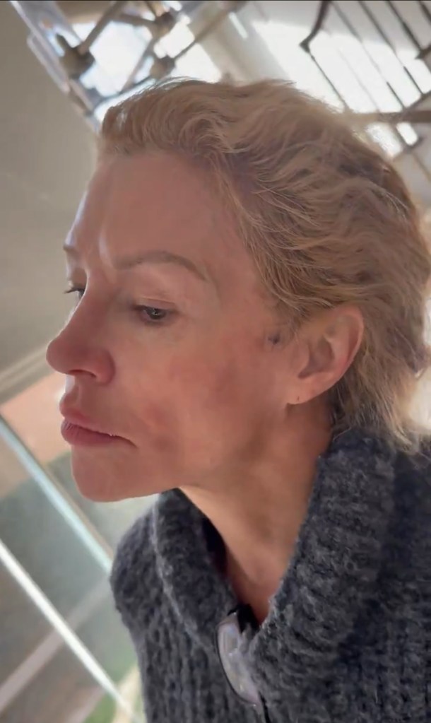 Brandi Glanville saw ‘something alive’ and ‘moving’ in her face in horrifying ultrasound
