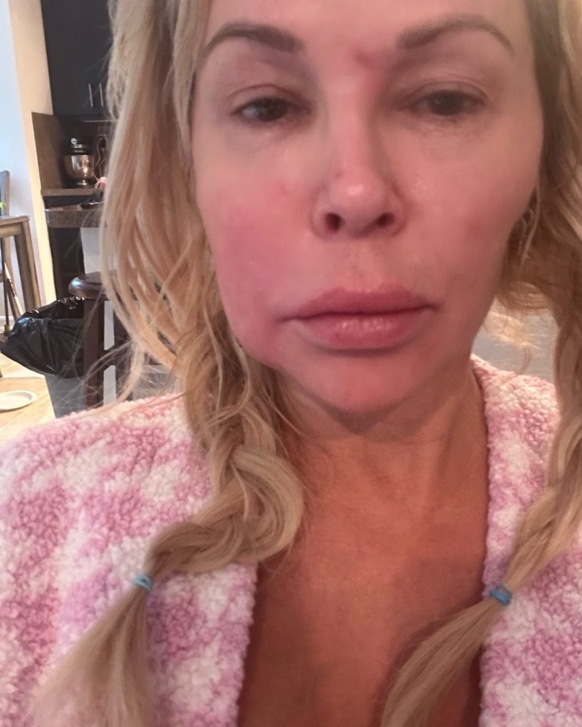 Brandi Glanville details daily 18-hour IV trips for ongoing health struggles: ‘I feel like death’