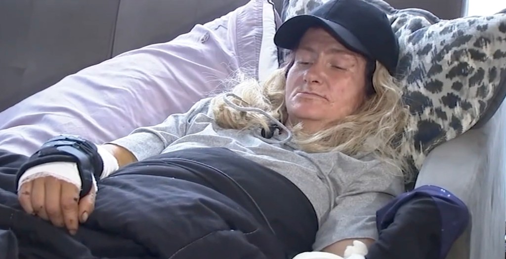 Woman horrifically mauled by massive pit bull in San Francisco reveals what really sparked attack