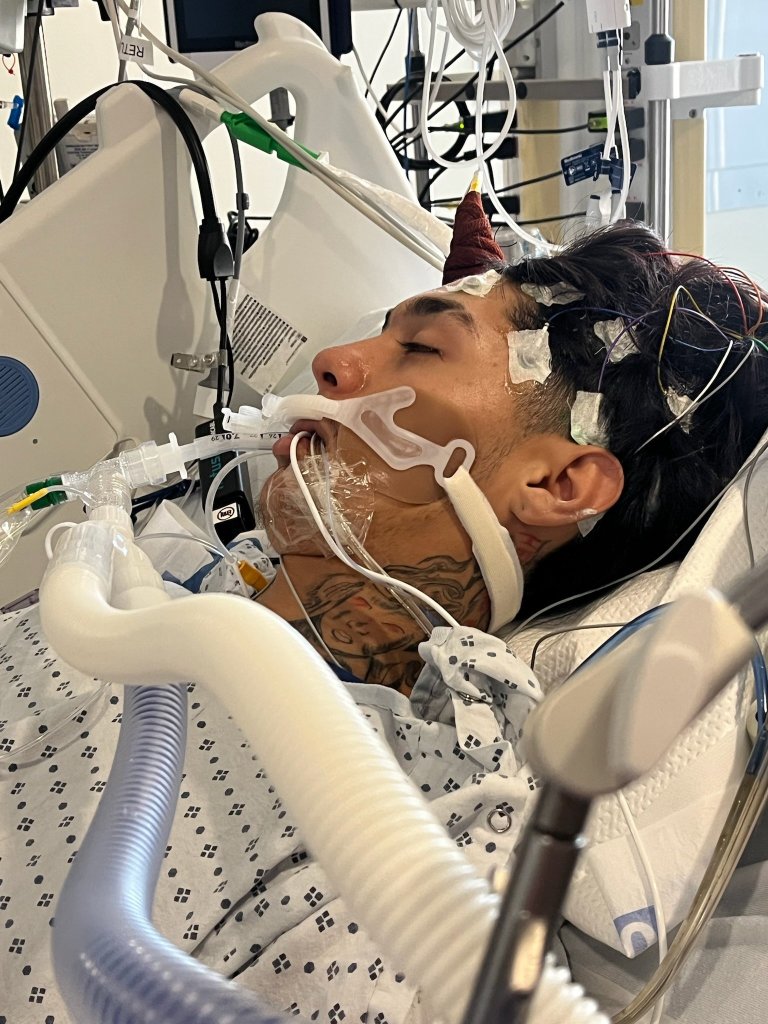 North Carolina teen dies from rare brain-eating amoeba typically linked to freshwater swimming