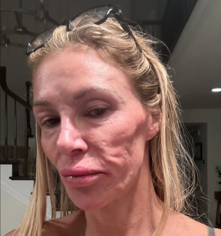 Brandi Glanville details daily 18-hour IV trips for ongoing health struggles: ‘I feel like death’