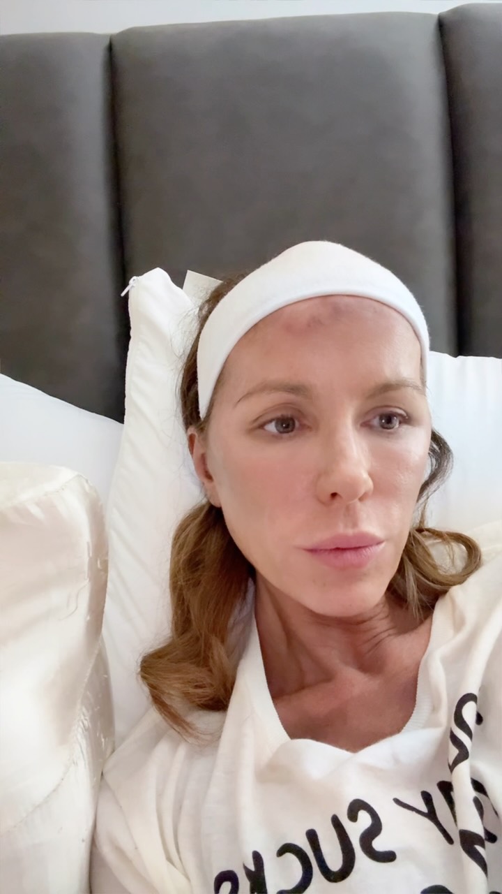 Kate Beckinsale shares heartbreaking message about navigating PTSD: ‘Actually like hell’