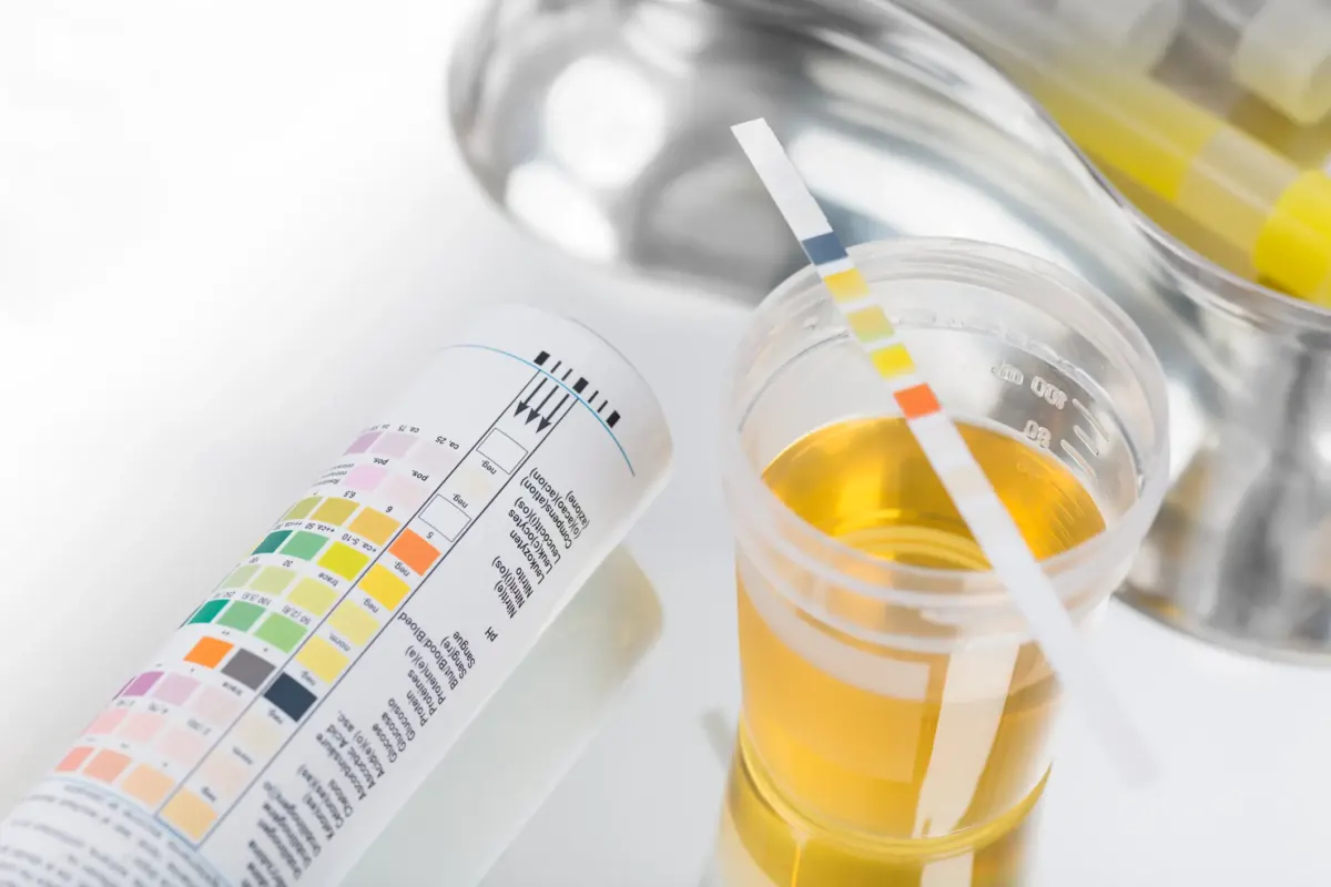 Scientists develop ‘zombie cell’ urine test that could spot common cancer before symptoms appear