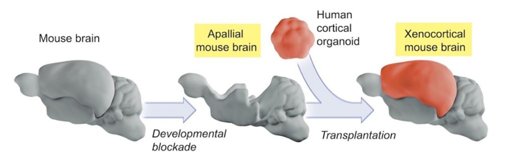 Stanford geniuses create lab rats with half-human brains