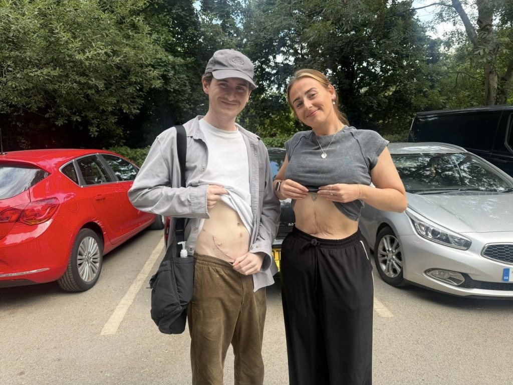 Sister saves her brother’s life by donating kidney after his rare diagnosis