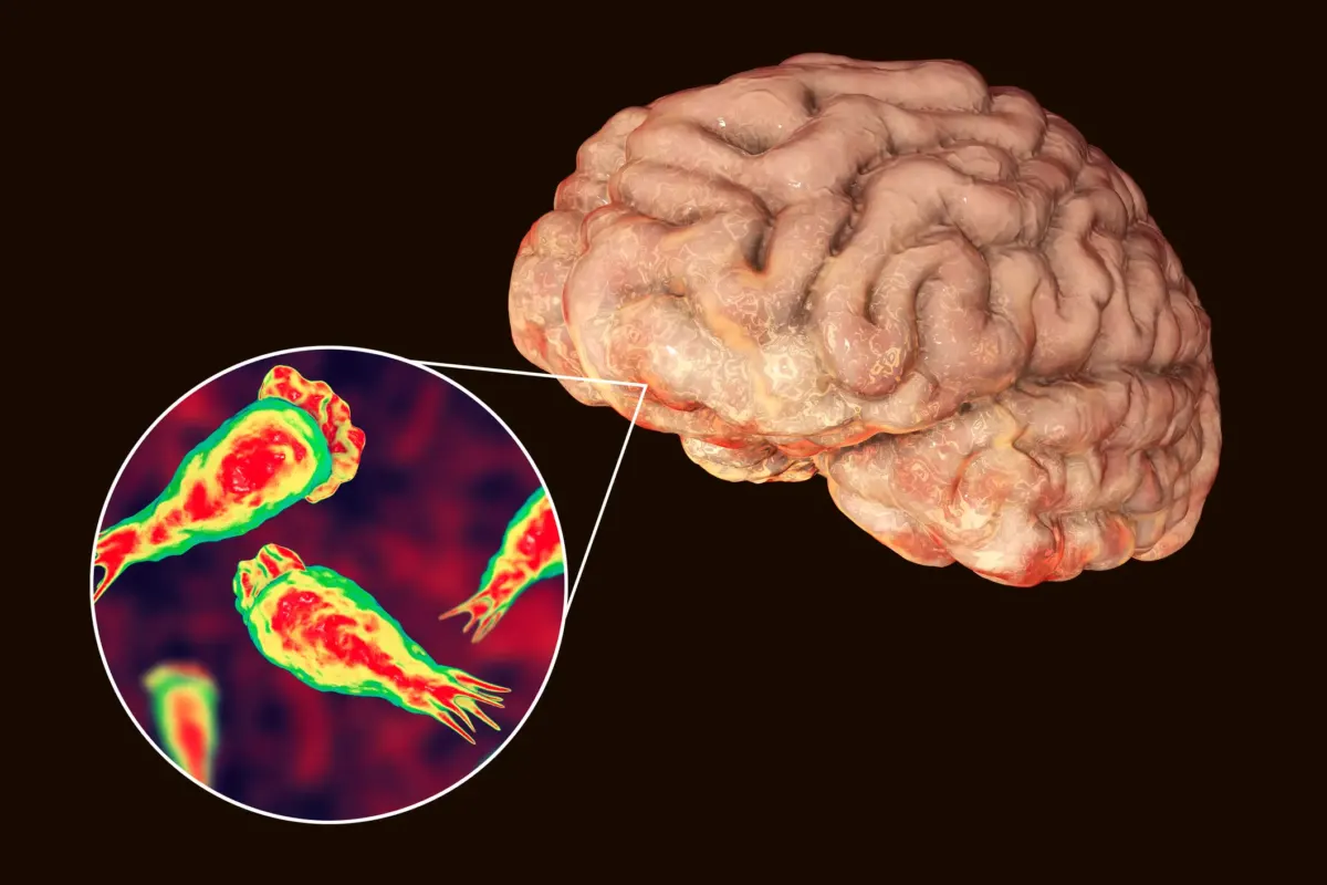 Family of teen who died of rare brain-eating amoeba are now begging doctors for answers