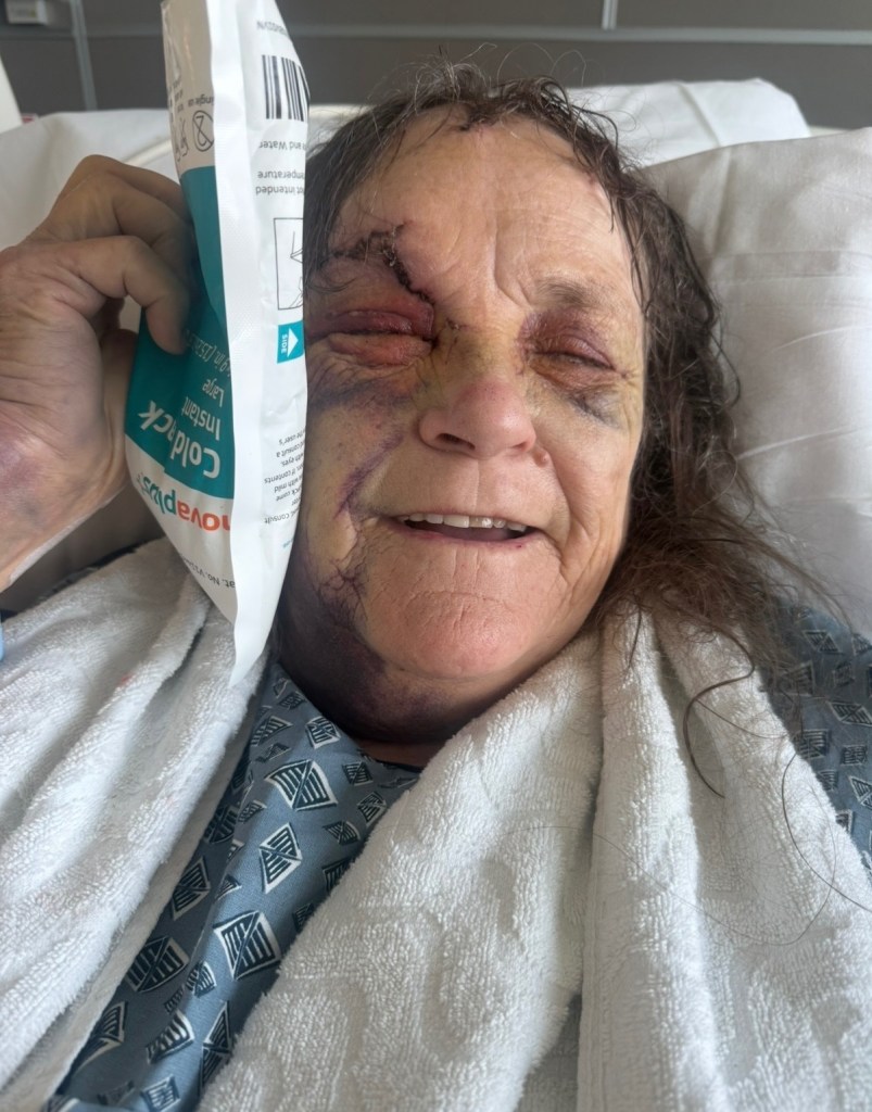 Baseball bat-wielding maniac who allegedly battered California grandmother is finally busted while on the run