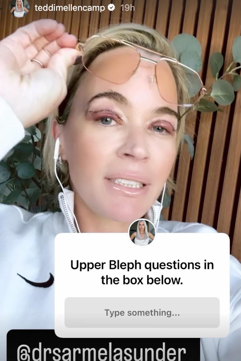 Teddi Mellencamp defends undergoing plastic surgery procedure during stage 4 cancer treatment