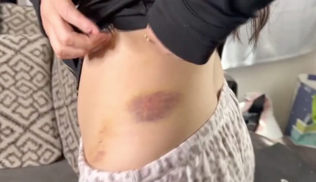 Deranged LA road-rage driver smashes woman’s car with crowbar, beats and bites her in savage attack caught on video
