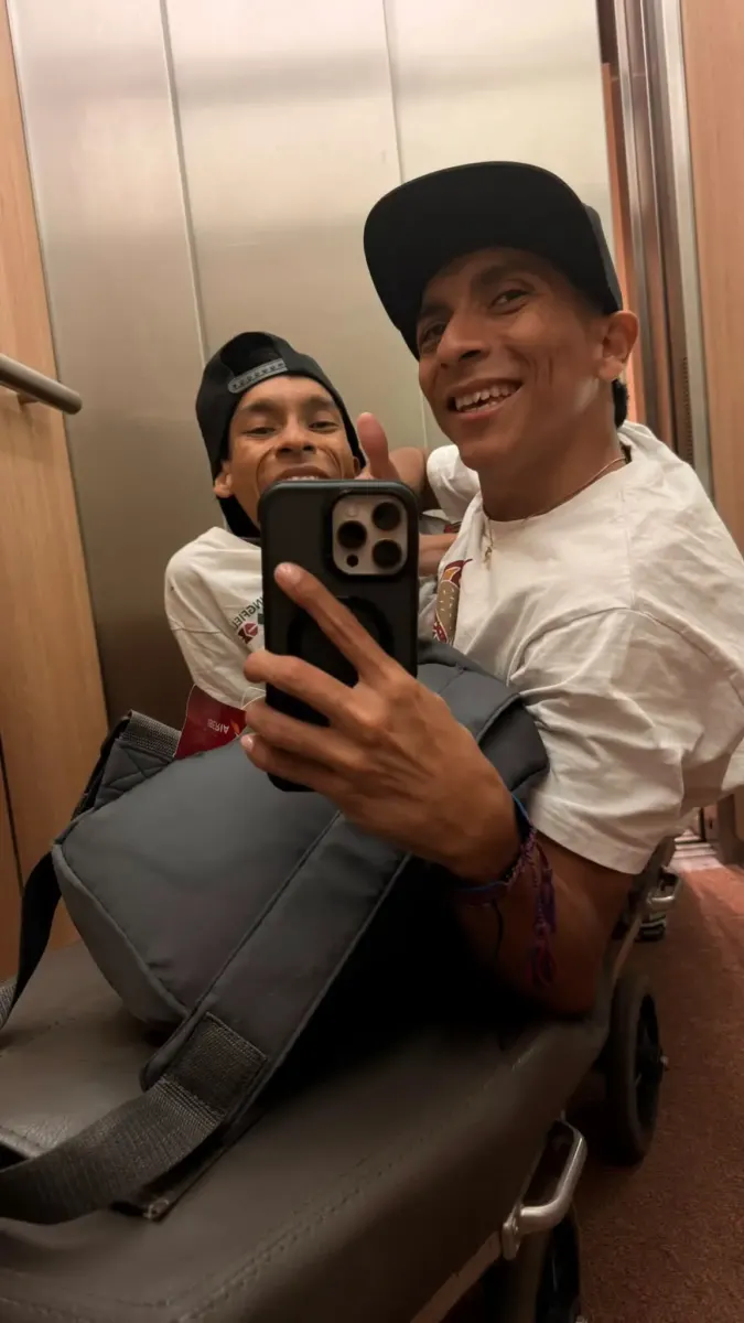 Conjoined twin influencers die aged 27 after one suffers heart attack