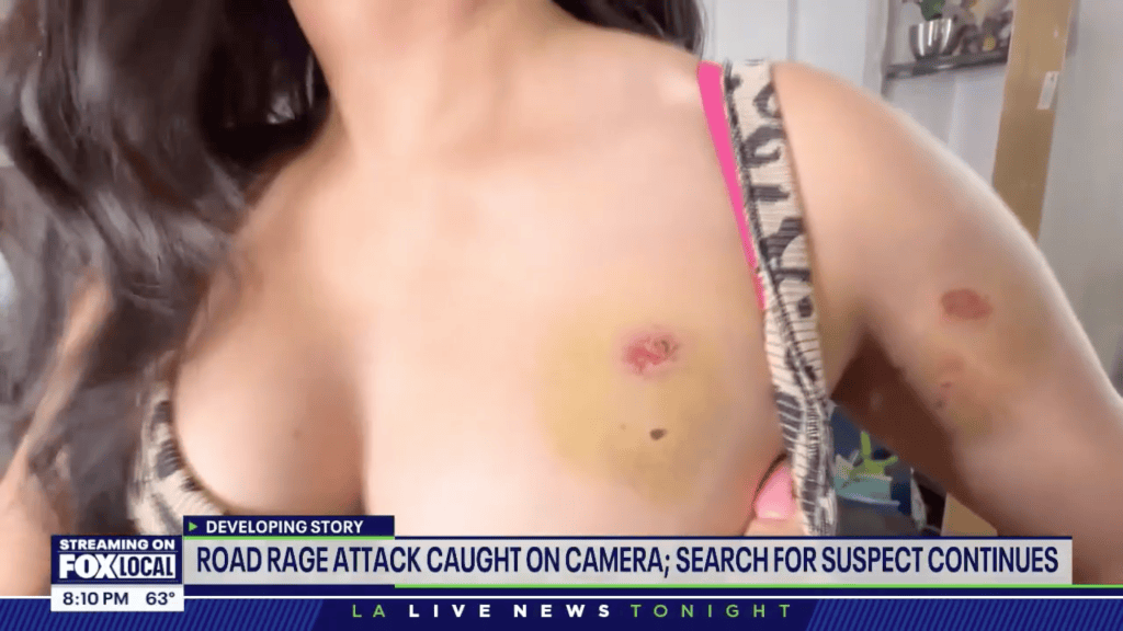 Deranged LA road-rage driver smashes woman’s car with crowbar, beats and bites her in savage attack caught on video