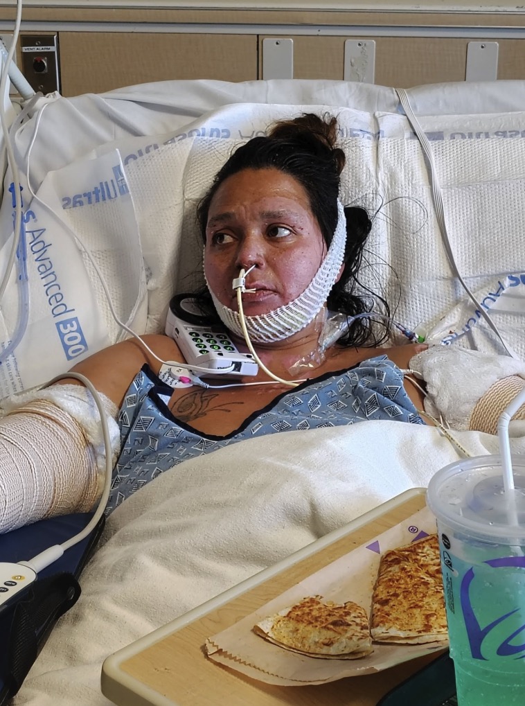 Family begs for justice after woman set on fire at California homeless camp dies