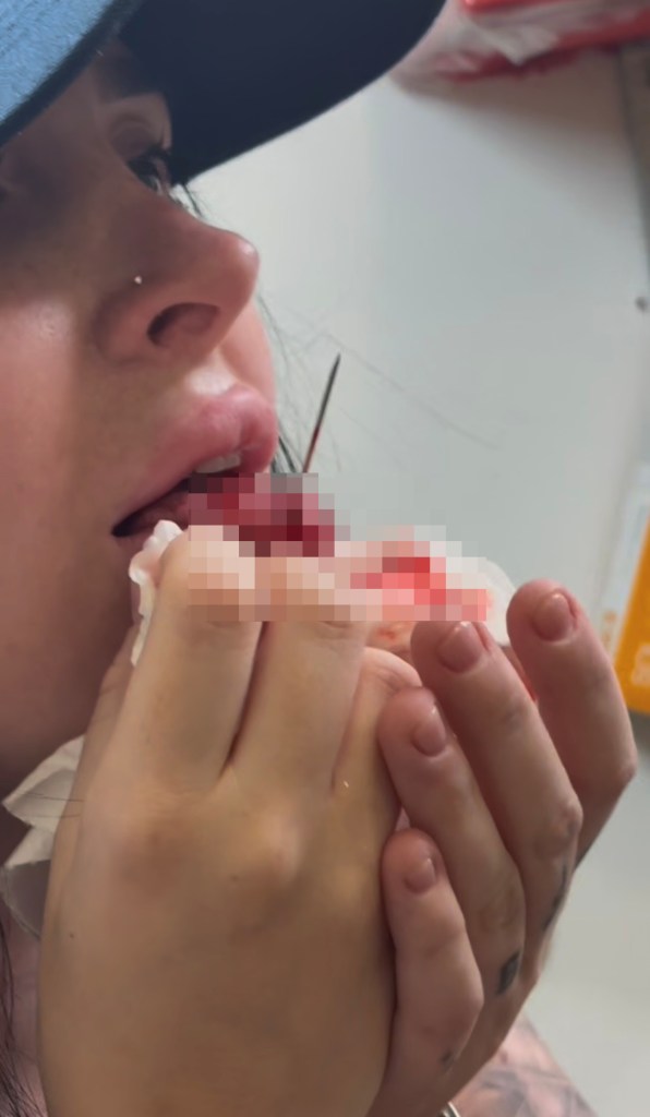 Shady NYC piercing shop butchered woman’s tongue, sending her to ER: lawsuit