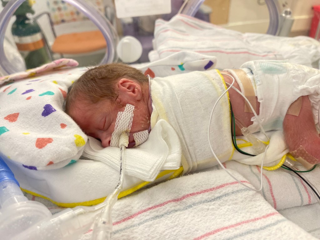 Premature twins separated at different Boston hospitals – as parents plead to reunite them before nurses’ strike