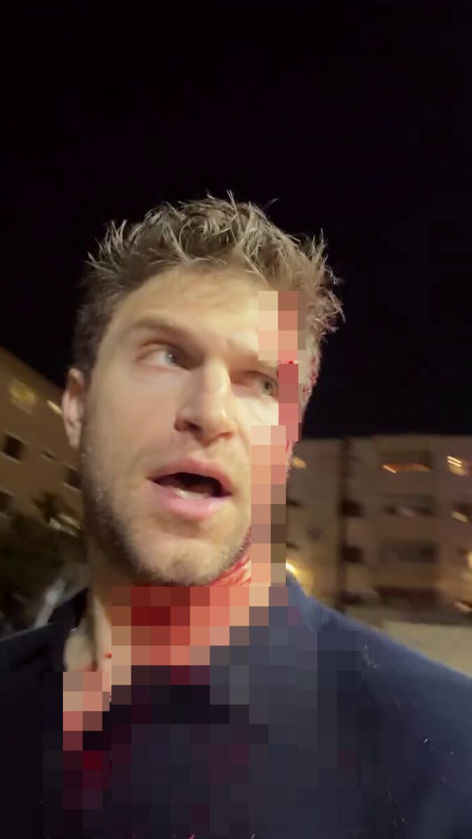 Keegan Allen 911 dispatch audio revealed after actor’s bloody LA grocery store attack