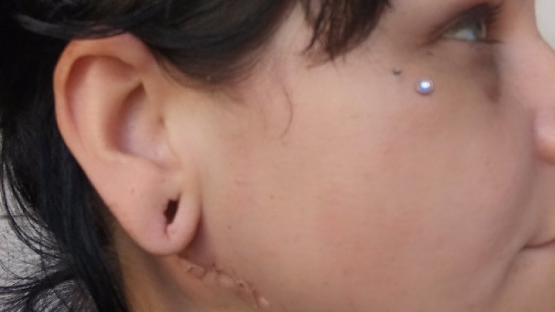 Bride-to-be stabbed in neck by fiancé just weeks before wedding