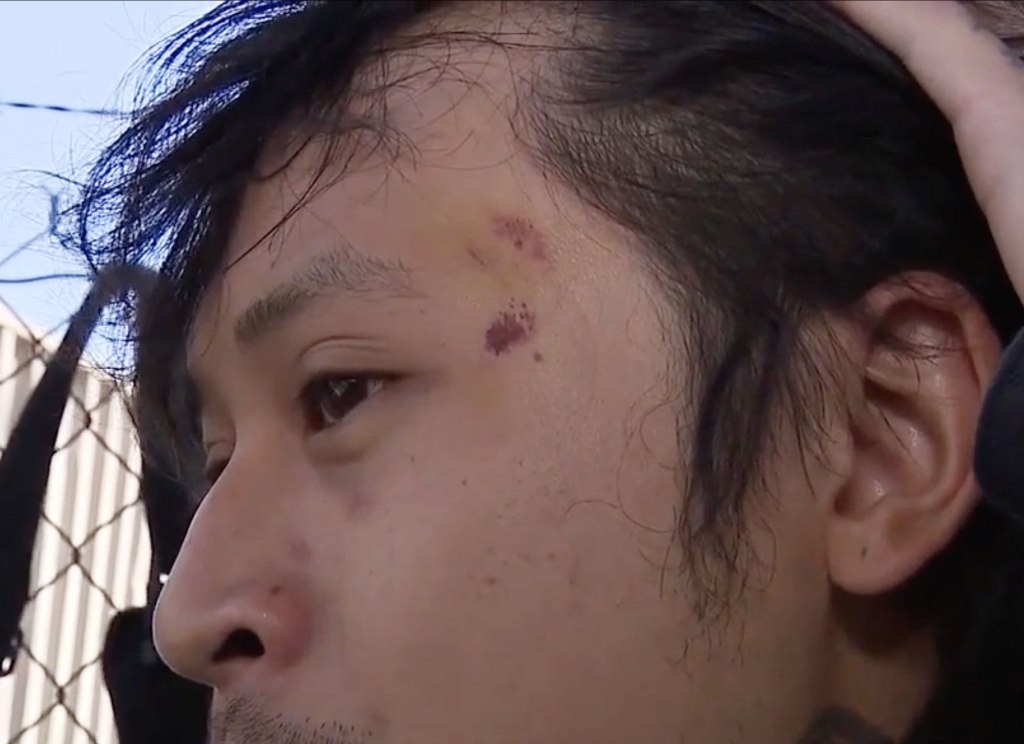 Social media interviewer choked, punched and stabbed by California ‘No Kings’ protesters