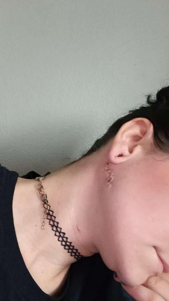 Bride-to-be stabbed in neck by fiancé just weeks before wedding