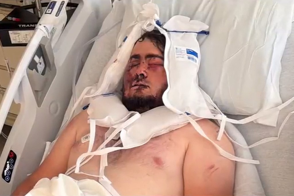 Fisherman trapped under massive boulder managed to get Siri to call 911: ‘It’s a miracle’