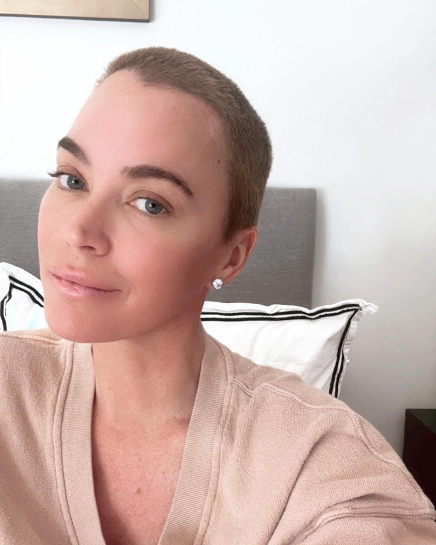 Teddi Mellencamp defends undergoing plastic surgery procedure during stage 4 cancer treatment