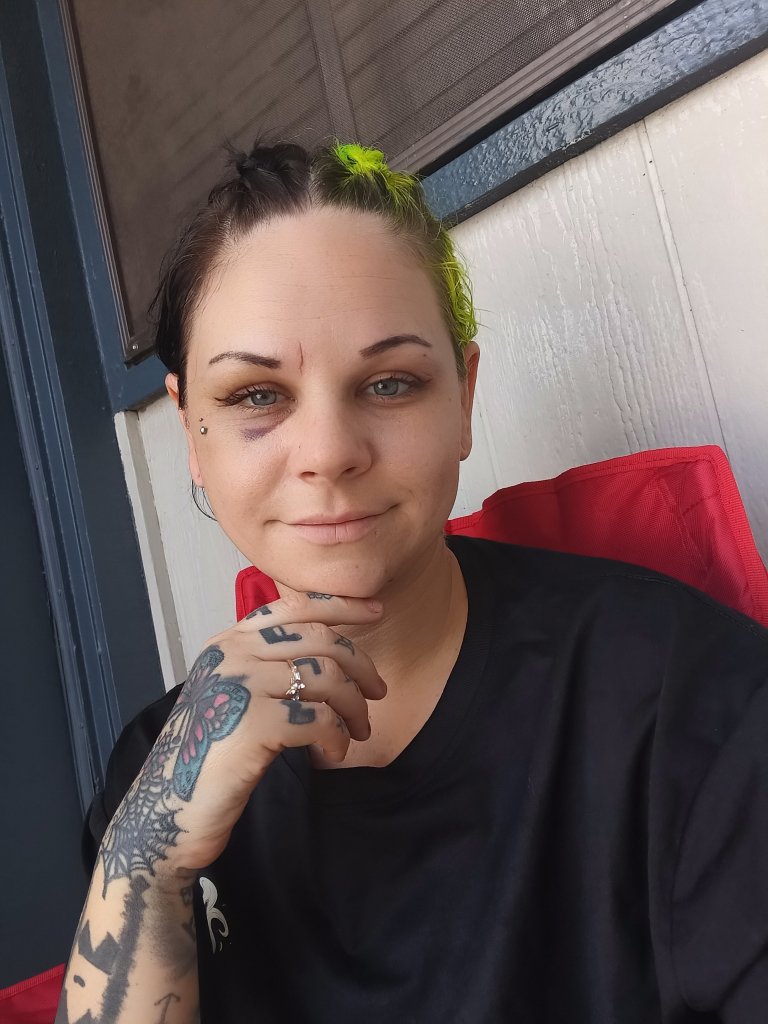 Bride-to-be stabbed in neck by fiancé just weeks before wedding