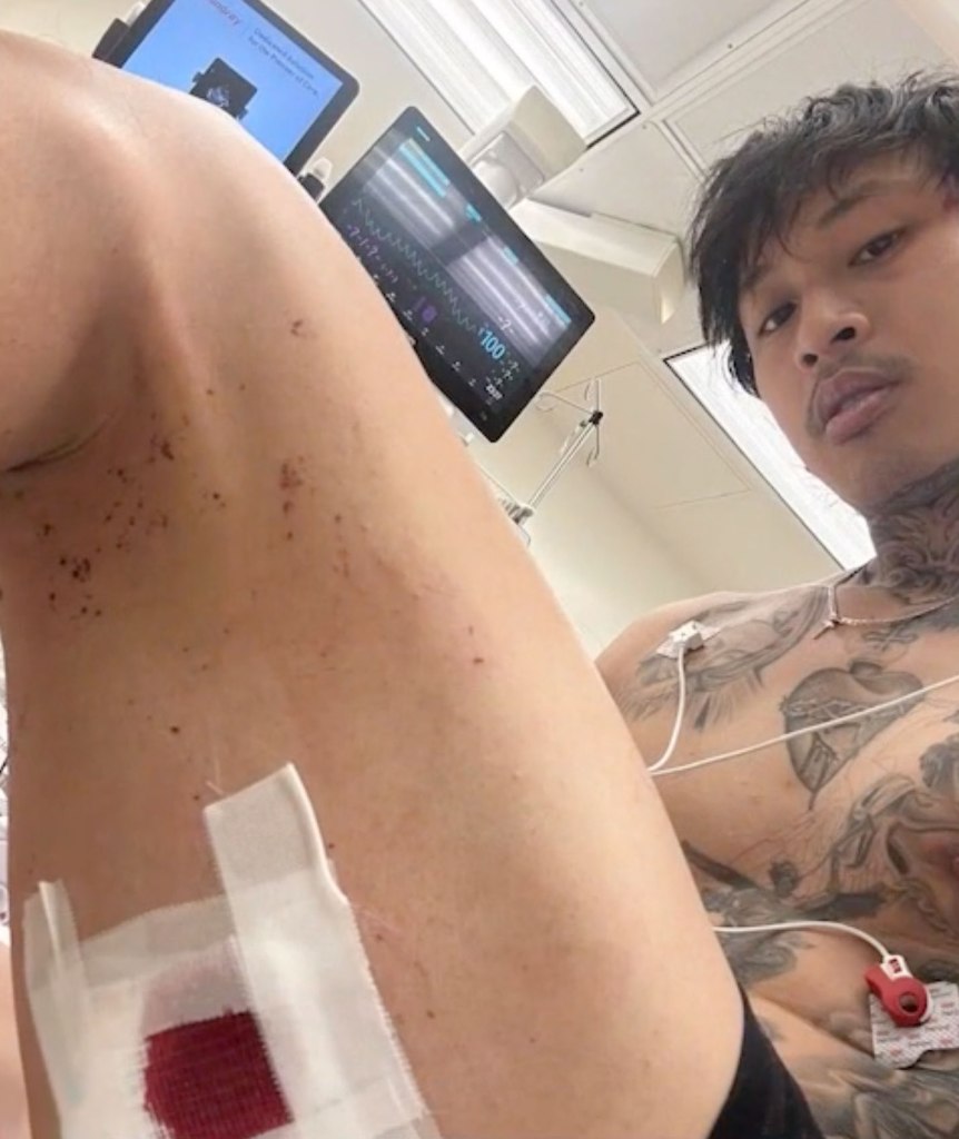 Social media interviewer choked, punched and stabbed by California ‘No Kings’ protesters