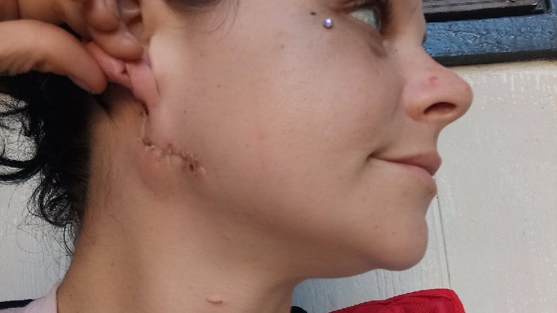 Bride-to-be stabbed in neck by fiancé just weeks before wedding