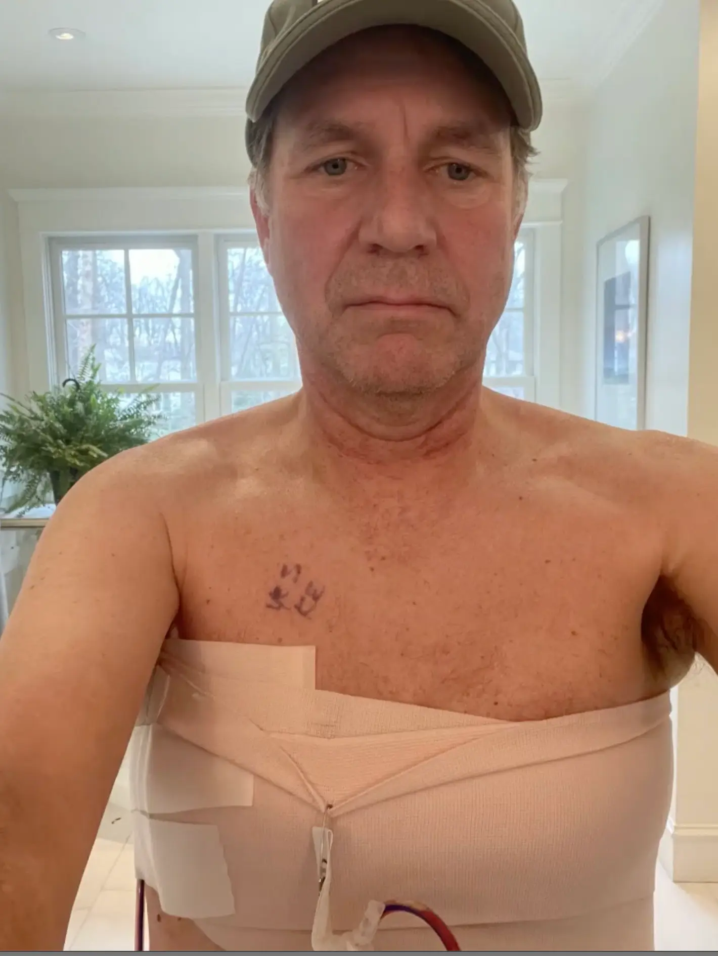 Man's friend twisted his nipple as a joke – and it led to a breast cancer diagnosis