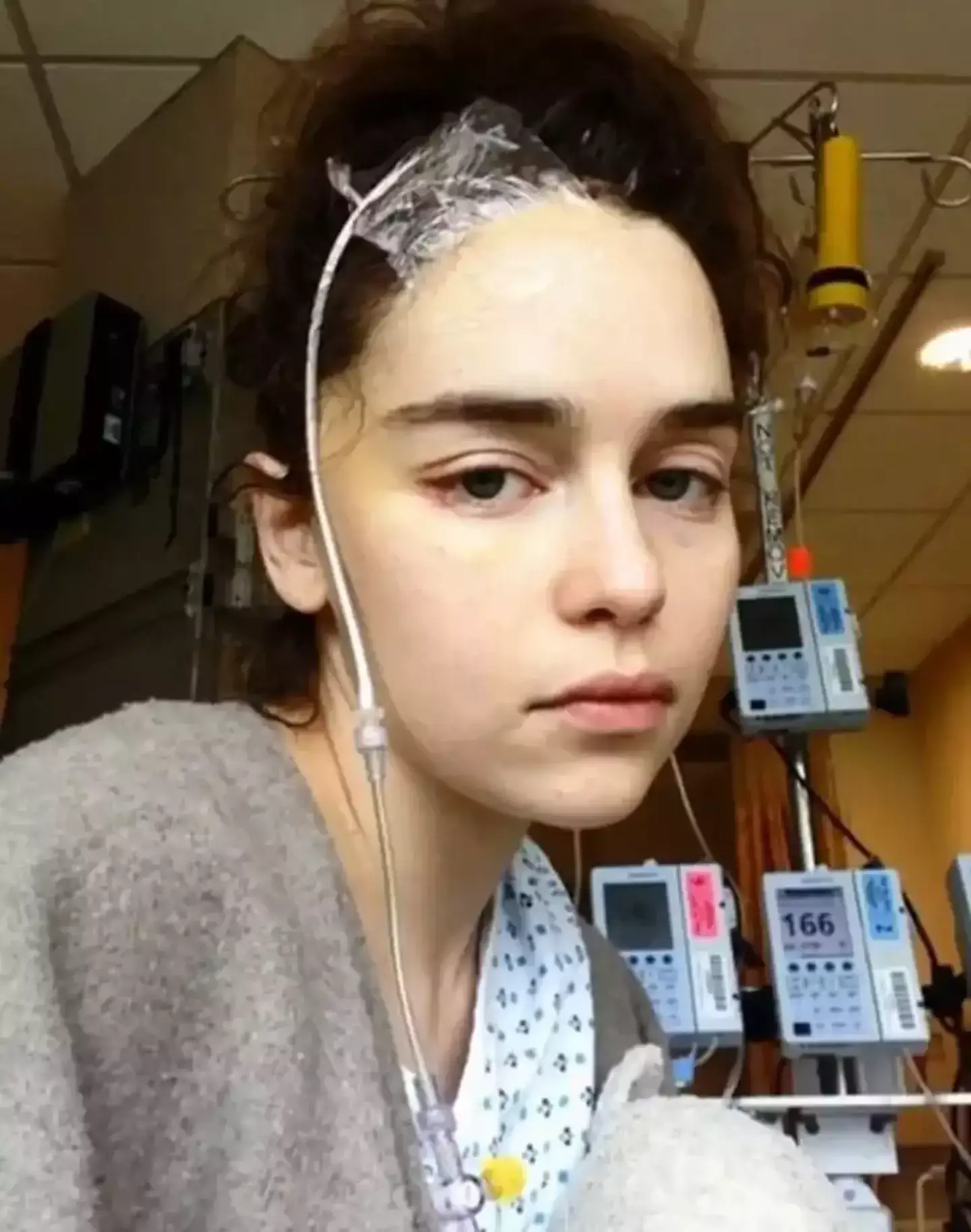 Emilia Clarke is missing 'quite a bit' of her brain after surviving two aneurysms in her life