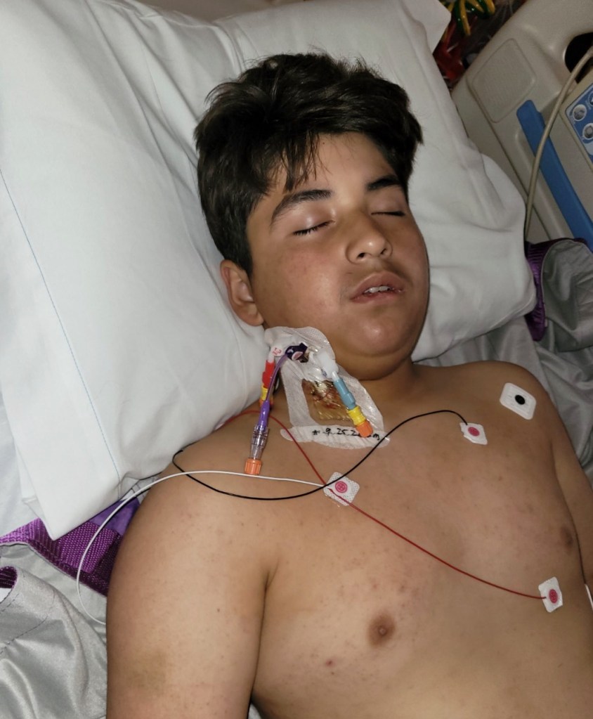 California boy, 13, left in grim condition after coming down with rare disease