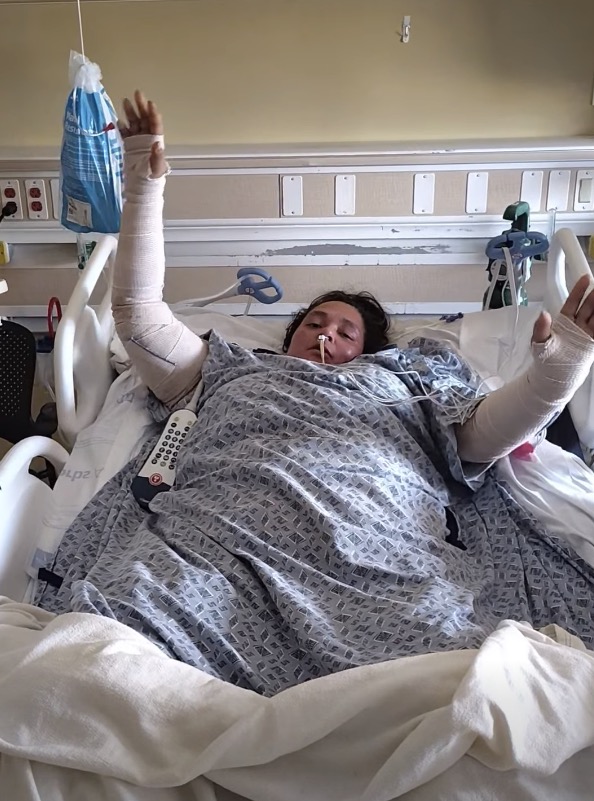 California woman left with horrific injuries after being covered in gas and set on fire during wild fight