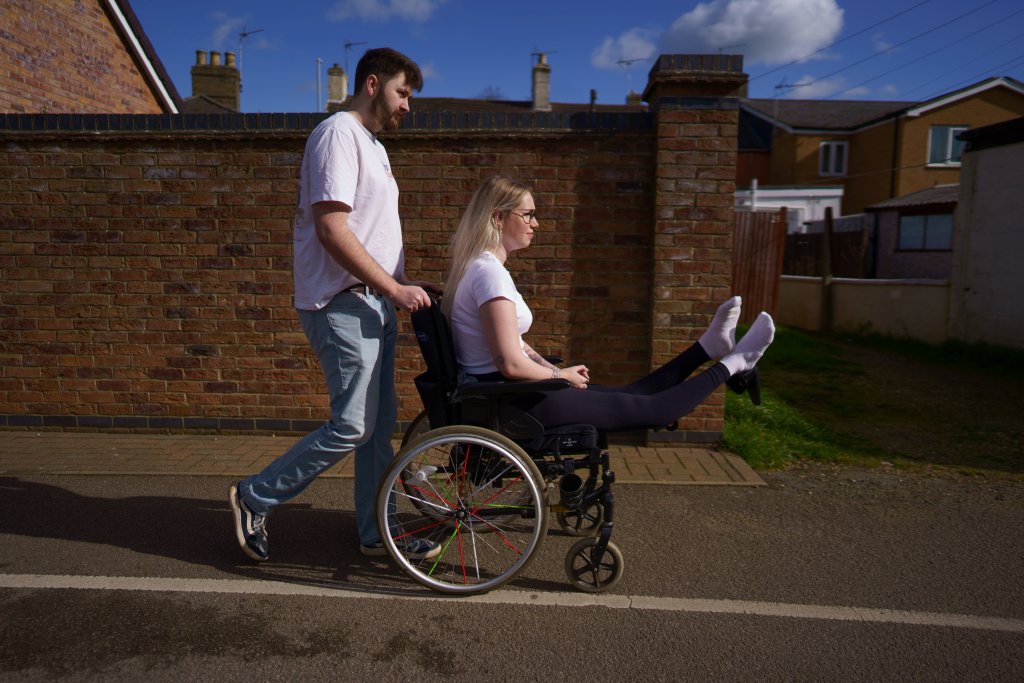Woman plans to have legs amputated after legs locked straight, bent backwards