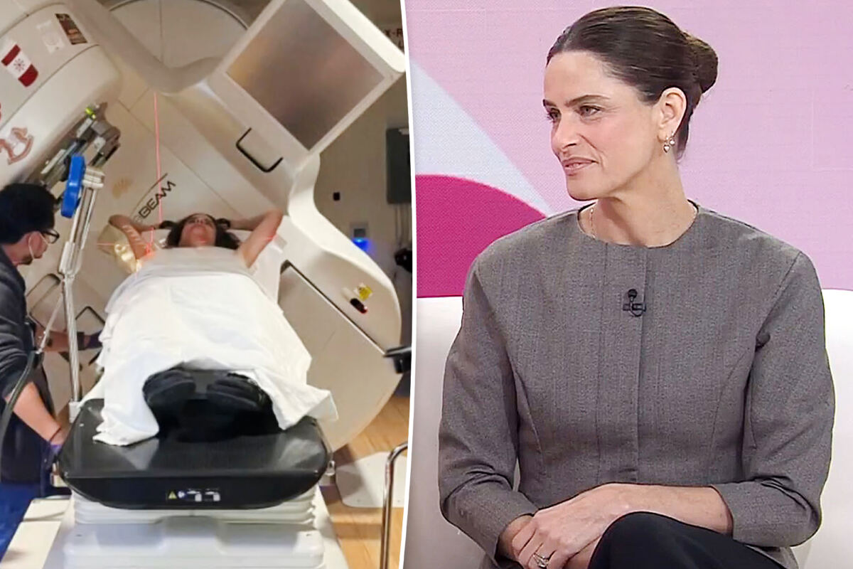 Amanda Peet noticed a 'weird' change to her body before being diagnosed with breast cancer