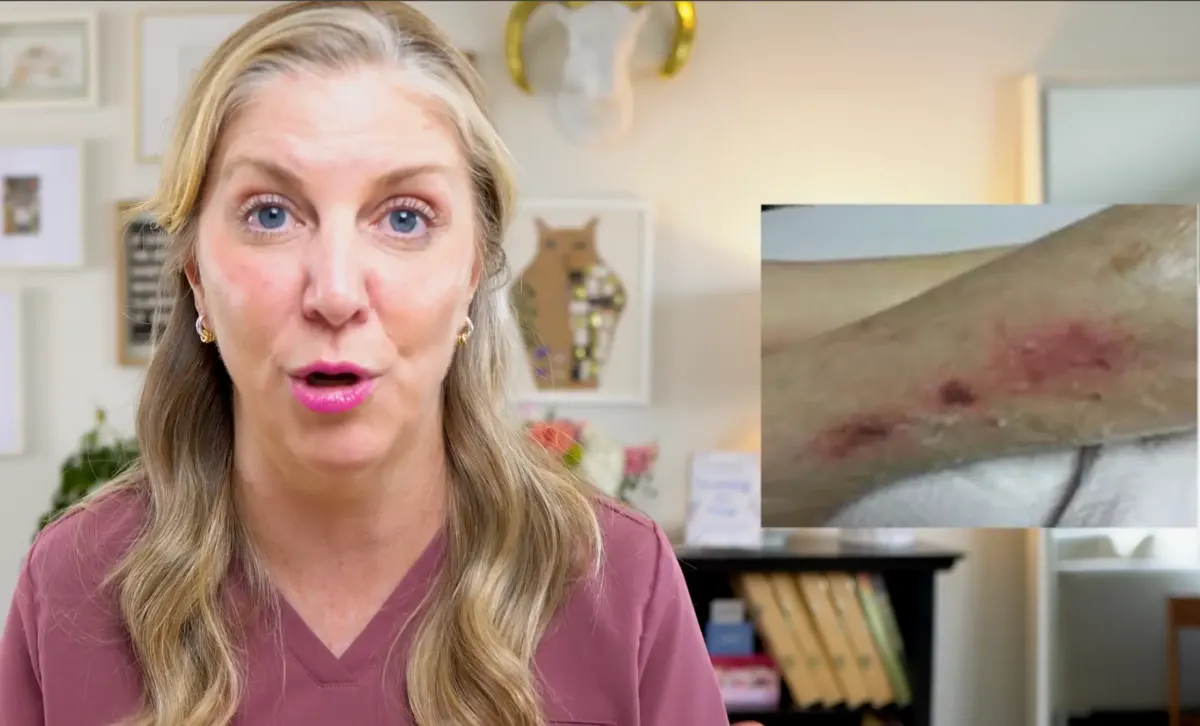 Hospice nurse reveals warning sign on skin that appears just days before death