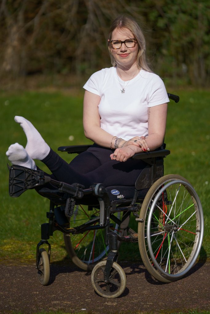 Woman plans to have legs amputated after legs locked straight, bent backwards