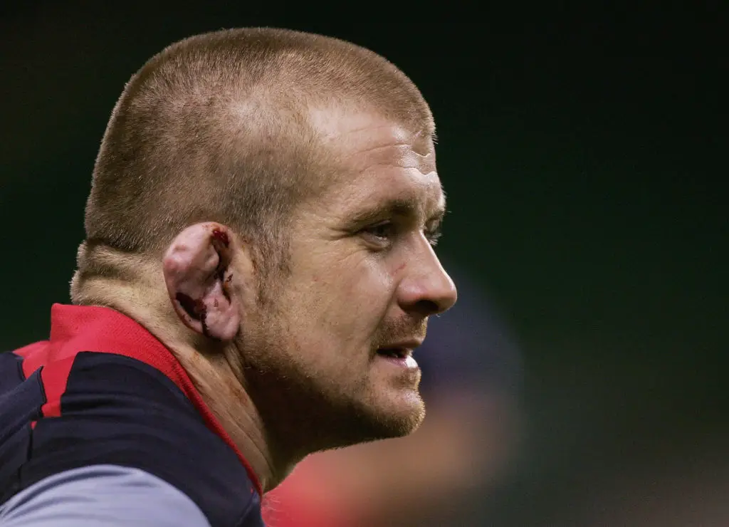 Men are having procedures to give themselves ‘cauliflower ear’ to look like MMA fighters
