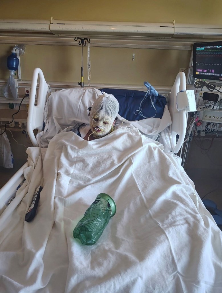 California woman left with horrific injuries after being covered in gas and set on fire during wild fight